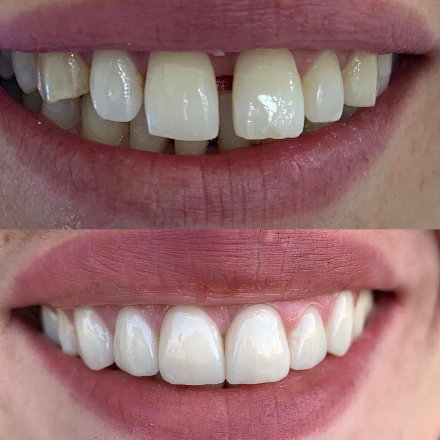 Recepsioni dhe ambienti i brendshëm i klinikës dentare GOJA Smiles në Prishtinë